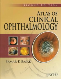 Image of Atlas Of Clinical Ophthalmology