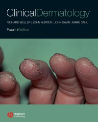 Image of Clinical Dermatology (Fourth Edition)