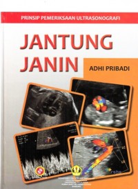 Image of Jantung Janin : Prinsip Pemeriksaan UIltrasonografi