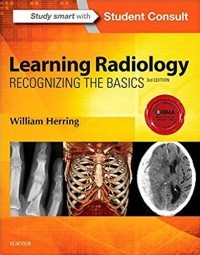 Image of Learning Radiology : Recognizing The Basics