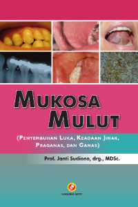 Image of Mukosa Mulut: Penyembuhan Luka, Keadaan Jinak, Praganas, Dan Ganas
